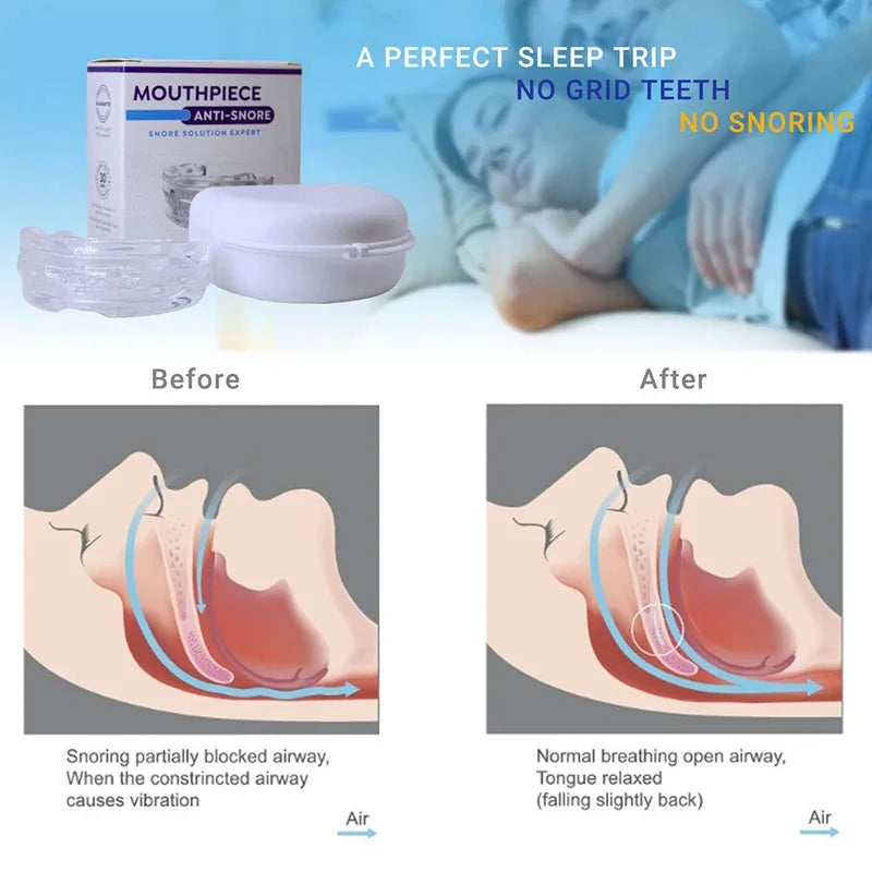 Sleep Apnea Mouth Guard For Jaw